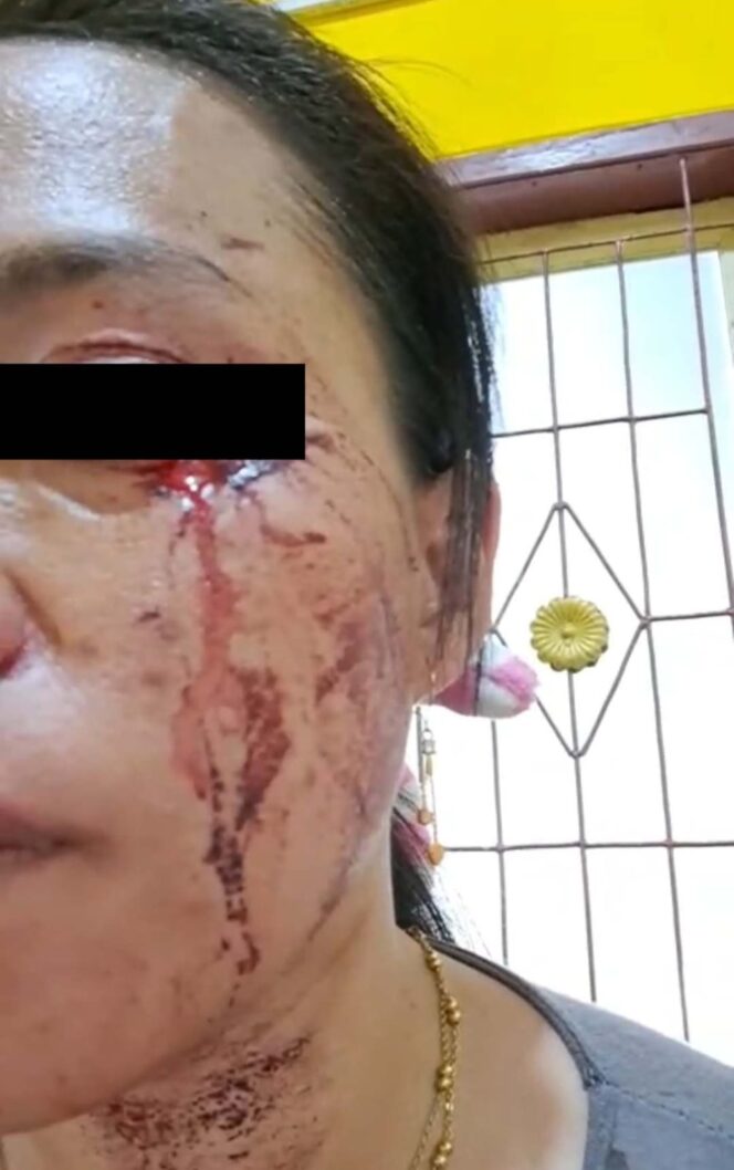 
 Seorang Ibu Menjadi Korban Pengeroyokan, Oleh 2 Orang Pelaku, Polres Sampang Terkesan Vakum