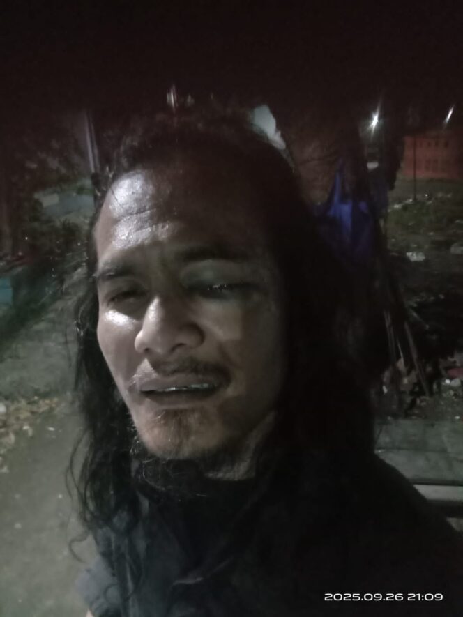
 Jurnalis Ambarita Dikeroyok Saat Liputan Dugaan Makanan Kedaluwarsa di Bekasi