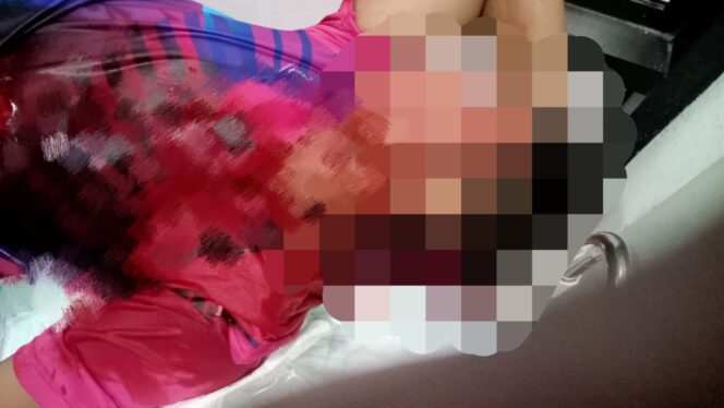 
 Pembacokan Sadis Pria Disampang Diserang Clurit Oleh Berapa Orang Luka Robek Dilengan dan Kepala