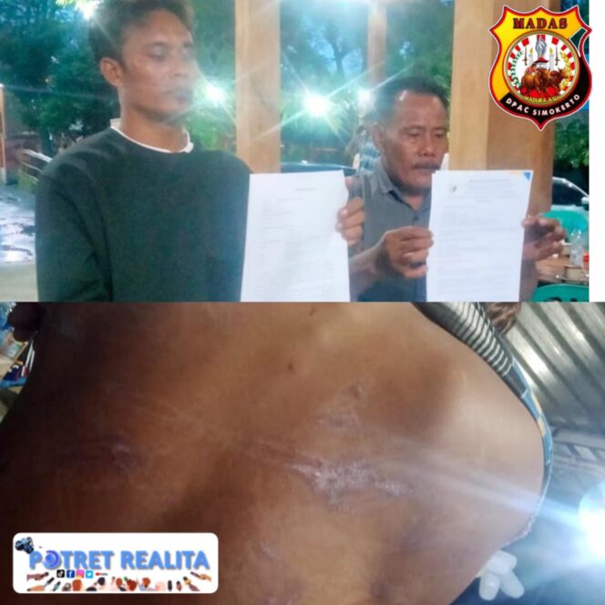 
 Ketum DPP MADAS Terima Kuasa Korban Dugaan Salah Tangkap dan Penganiayaan, Tuntut Kapolres dan Kasatreskrim Tuban Dicopot