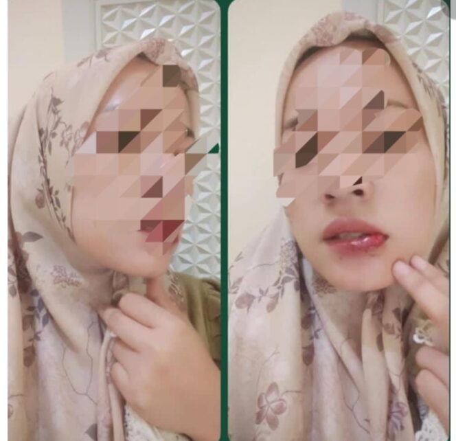 
 Klaim Korban Penganiayaan di Bangkalan Disorot, Publik Nilai Narasi Tak Sejalan Fakta