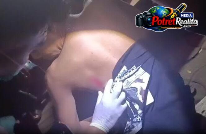 
 Malam Takbiran Mencekam, Dua Pemuda Dibacok Gerombolan Bermotor di Jalan Dupak Surabaya